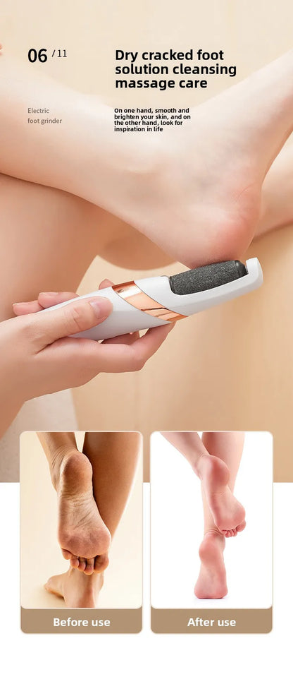 Electric Foot Grinder – Rechargeable Callus Remover for Smooth & Healthy Feet