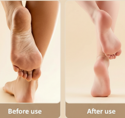 Electric Foot Grinder – Rechargeable Callus Remover for Smooth & Healthy Feet